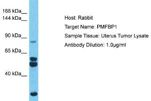 Host: Rabbit Target Name: PMFBP1 Sample Type: Uterus Tumor lysates Antibody Dilution: 1.