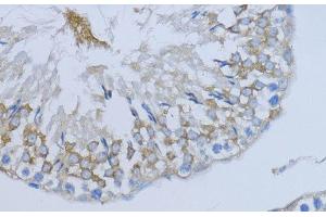 Immunohistochemistry of paraffin-embedded Rat testis using NRG4 Polyclonal Antibody at dilution of 1:200 (40x lens). (Neuregulin 4 antibody)