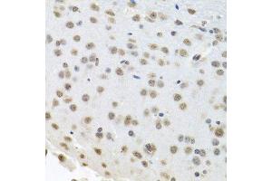 Immunohistochemistry (Paraffin-embedded Sections) (IHC (p)) image for anti-ELAV (Embryonic Lethal, Abnormal Vision, Drosophila)-Like 1 (Hu Antigen R) (ELAVL1) (AA 1-100) antibody (ABIN6140112)