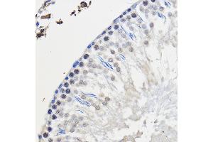 Immunohistochemistry (IHC) image for anti-Heterogeneous Nuclear Ribonucleoprotein U (Scaffold Attachment Factor A) (HNRNPU) (AA 608-825) antibody (ABIN1680323)