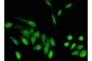 Immunofluorescent analysis of Hela cells using ABIN7163848 at dilution of 1:100 and Alexa Fluor 488-congugated AffiniPure Goat Anti-Rabbit IgG(H+L) (POLDIP2 antibody  (AA 1-200))