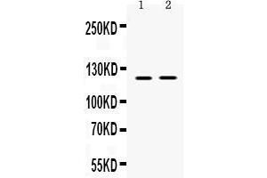 Western blot analysis of Ceruloplasmin expression in rat skeletal muscle extract ( Lane 1), and NIH3T3 whole cell lysates ( Lane 2). (Ceruloplasmin antibody  (AA 20-258))