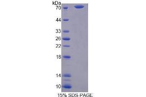 SDS-PAGE (SDS) image for serpin Peptidase Inhibitor, Clade A (Alpha-1 Antiproteinase, Antitrypsin), Member 10 (SERPINA10) (AA 24-444) protein (His tag,GST tag) (ABIN3209928)