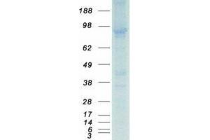 Validation with Western Blot (PDE5A Protein (Transcript Variant 2) (Myc-DYKDDDDK Tag))