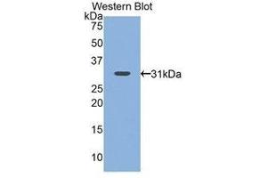 Western Blotting (WB) image for anti-Nicotinamide N-Methyltransferase (NNMT) (AA 1-258) antibody (ABIN1860015) (NNMT antibody  (AA 1-258))
