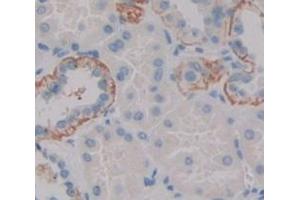 IHC-P analysis of Human Tissue, with DAB staining. (CYP1B1 antibody  (AA 374-516))