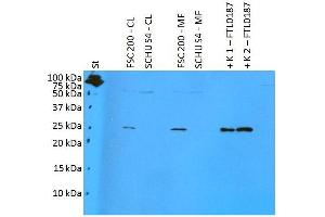 Western blotting analysis of polyclonal anti-Francisella tularensis subsp. (FTL0187 antibody)