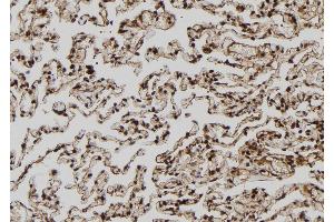 ABIN6272508 at 1/100 staining Human lung tissue by IHC-P. (MAGEA8 antibody  (C-Term))