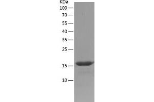 CABYR Protein (AA 26-150) (His tag)