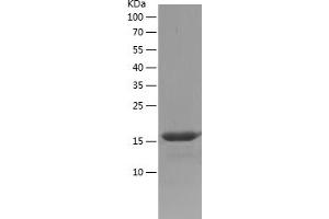 Western Blotting (WB) image for Calcium Binding tyrosine-(Y)-phosphorylation Regulated (CABYR) (AA 26-150) protein (His tag) (ABIN7282127) (CABYR Protein (AA 26-150) (His tag))