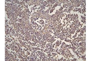 IHC analysis of HOOK3 using anti-HOOK3 antibody (ABIN6719547).