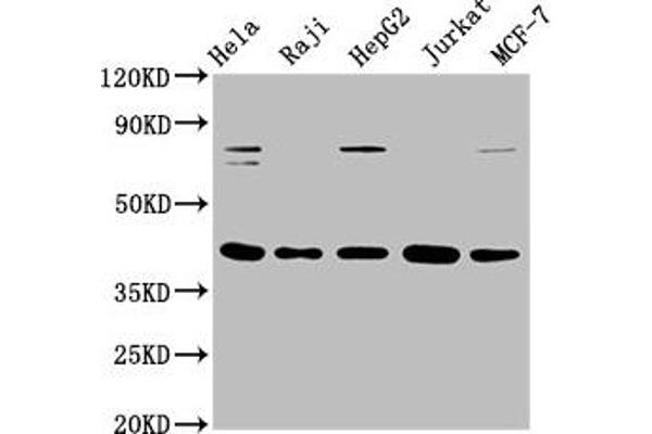 Recombinant FEN1 antibody