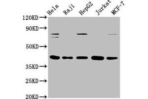 Western Blot Positive WB detected in: Hela whole cell lysate, Raji whole cell lysate, HepG2 whole cell lysate, Jurkat whole cell lysate, MCF-7 whole cell lysate All lanes: FEN1 antibody at 0. (Recombinant FEN1 antibody)