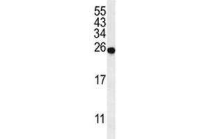 Western blot analysis of SPR antibody and mouse liver tissue lysate. (SPR antibody  (AA 231-260))