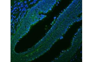 IF analysis of Citrin/SLC25A13 using anti-Citrin/SLC25A13 antibody (ABIN7599512). (slc25a13 antibody  (AA 1-643))