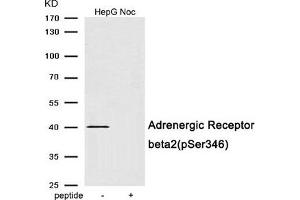 Western blot analysis of extracts from HepG2 cells treated with Nocodazole using Phospho-Adrenergic Receptor beta2 (Ser346) antibody. (beta 2 Adrenergic Receptor antibody  (pSer346))