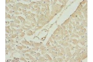 Immunohistochemistry of paraffin-embedded human heart tissue using ABIN7167204 at dilution of 1:100 (RAC3 antibody  (AA 1-192))
