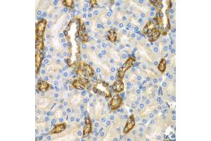 Immunohistochemistry of paraffin-embedded mouse kidney using CNPY3 antibody. (TNRC5 antibody)