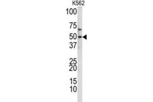 Western Blotting (WB) image for anti-Kruppel-Like Factor 11 (KLF11) antibody (ABIN3002716)