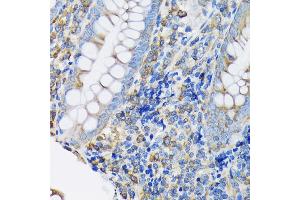Immunohistochemistry (IHC) image for anti-Eukaryotic Translation Elongation Factor 2 (EEF2) antibody (ABIN7267025)