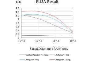 Black line: Control Antigen (100 ng),Purple line: Antigen (10 ng), Blue line: Antigen (50 ng), Red line:Antigen (100 ng) (SARS-Cov2-NP2 (AA 120-300) antibody)