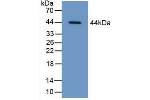 Detection of Recombinant CAP3, Human using Polyclonal Antibody to Cytoplasmic Antiproteinase 3 (CAP3) (SERPINB9 antibody  (AA 1-376))