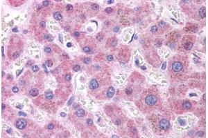 Human Liver: Formalin-Fixed, Paraffin-Embedded (FFPE) (APOB antibody  (AA 4031-4080))