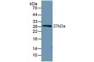 Western blot analysis of recombinant Mouse PCK1.