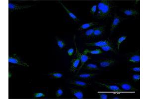 Immunofluorescence of purified MaxPab antibody to ZFYVE16 on HeLa cell. (ZFYVE16 antibody  (AA 1-809))