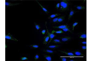 Immunofluorescence of purified MaxPab antibody to ZFYVE16 on HeLa cell.