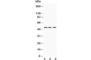 Western blot testing of ANGPTL4 antibody and Lane 1:  human placenta;  2: SMMC-7721;  3: HeLa;  Predicted size: 50KD;  Observed size: 50KD (ANGPTL4 antibody  (C-Term))