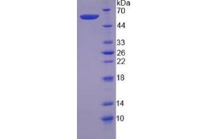 SDS-PAGE (SDS) image for Calpain 6 (CAPN6) (AA 26-495) protein (His tag) (ABIN4990381)