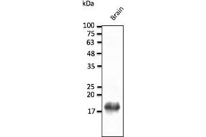 Western Blotting (WB) image for anti-Synuclein, beta (SNCB) (C-Term) antibody (ABIN7273028) (beta Synuclein antibody  (C-Term))