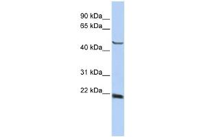 WB Suggested Anti-SSX4 Antibody Titration:  0. (SSX4 antibody  (Middle Region))