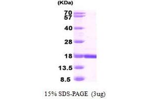 SDS-PAGE (SDS) image for Retinol Binding Protein 7, Cellular (RBP7) (AA 1-134) protein (His tag) (ABIN667367) (RBP7 Protein (AA 1-134) (His tag))