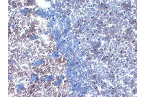 PICK1 Immunohistochemistry. (PICK1 antibody)
