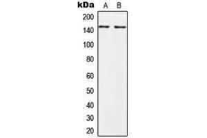 Western blot analysis of PALLD expression in HeLa (A), PC3 (B) whole cell lysates. (PALLD antibody  (Center))