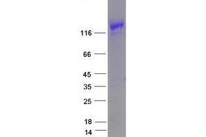Validation with Western Blot