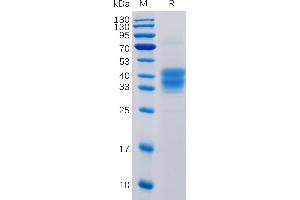 CD52 (CD52) (AA 25-36) protein (mFc Tag)