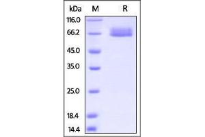 Cynomolgus IL-4 R alpha, Fc Tag on SDS-PAGE under reducing (R) condition. (IL4 Receptor Protein (AA 26-232) (Fc Tag))