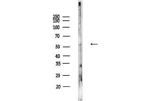 Western blot analysis of lysates from HUVEC cells, using Asparagine synthetase Antibody at 1/1000 dilution.