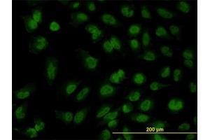 Image no. 3 for anti-Forkhead Box R2 (FOXR2) (AA 1-312) antibody (ABIN599326) (FOXR2 antibody  (AA 1-312))