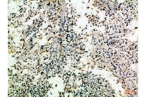 Immunohistochemical analysis of paraffin-embedded Human-spleen, antibody was diluted at 1:100 (CD8 antibody  (AA 100-160))