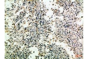 Immunohistochemical analysis of paraffin-embedded Human-spleen, antibody was diluted at 1:100