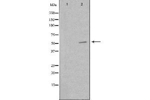 Western blot analysis of extracts from HepG2cells, using PKNOX2 antibody. (PKNOX2 antibody  (C-Term))