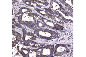 IHC analysis of MRE11 using anti-MRE11 antibody . (Mre11 antibody  (AA 2-239))