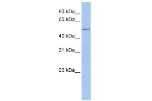 WB Suggested Anti-EIF5 Antibody Titration: 0. (EIF5 antibody  (N-Term))