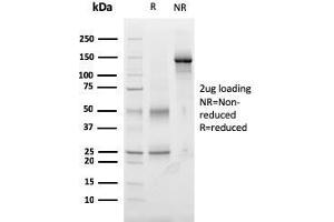 SDS-PAGE Analysis Purified Monospecific Mouse Monoclonal Antibody to TIGIT (TIGIT/3017). (TIGIT antibody  (AA 22-141))