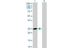 Western Blot analysis of HECTD3 expression in transfected 293T cell line by HECTD3 MaxPab polyclonal antibody. (HECTD3 antibody  (AA 1-210))