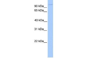 WB Suggested Anti-NUP98 Antibody Titration: 0. (NUP98 antibody  (N-Term))